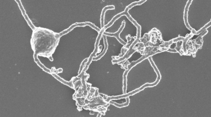 Microbiologists took 12 years to grow a microbe tied to complex life’s origins