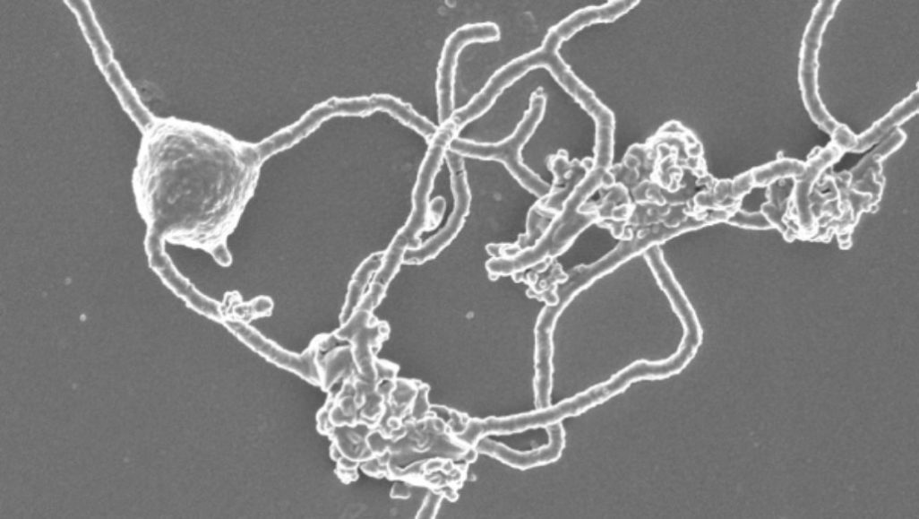 Microbiologists took 12 years to grow a microbe tied to complex life’s origins