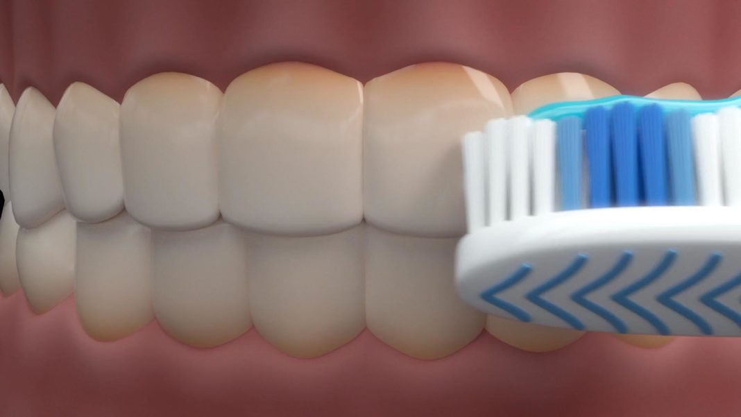 Plaque Identifying Toothpaste May Prevent Heart Attacks and Strokes