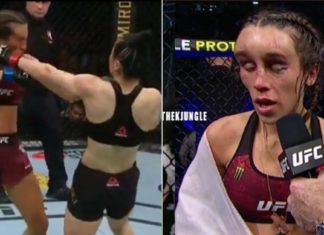 SCARY: Images of Joanna Jedrzejczyk After the Fight Revealed