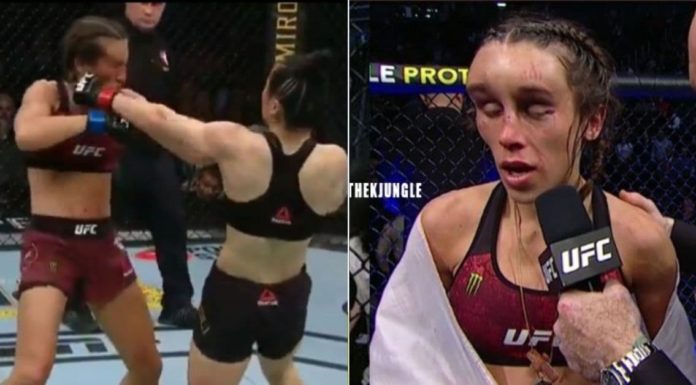 SCARY: Images of Joanna Jedrzejczyk After the Fight Revealed