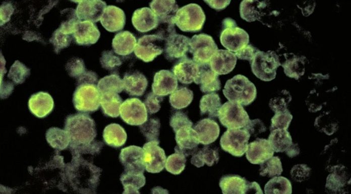 Brain-eating amoeba: Warning issued in Florida after rare infection case
