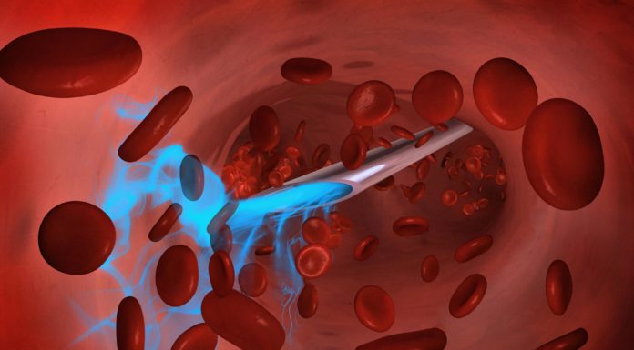 Researchers Develop a New Ultrafast Insulin for Management of Blood Sugar in Diabetes