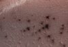 ‘Spiders’ on Mars: Scientists Reveal the Bizarre Blobs Sprawling Across the Martian Surface